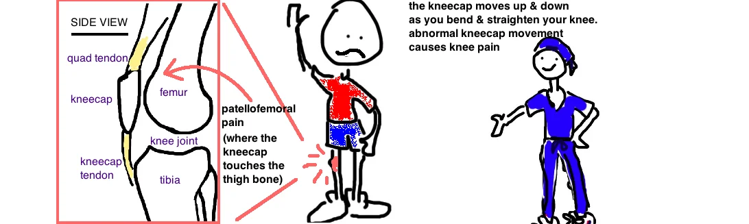 Teenage sale knee pain